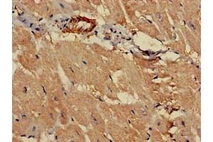 Immunohistochemistry of paraffin-embedded human heart tissue using ABIN7164812 at dilution of 1:100