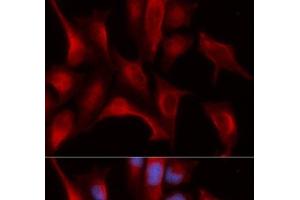 Immunofluorescence analysis of U2OS cells using PSMB4 Polyclonal Antibody (PSMB4 antibody)