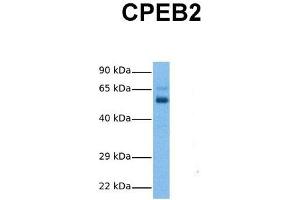 Host:  Rabbit  Target Name:  CPEB2  Sample Tissue:  Human Ovary Tumor  Antibody Dilution:  1. (CPEB2 antibody  (Middle Region))