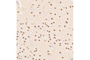 Immunohistochemistry (Paraffin-embedded Sections) (IHC (p)) image for anti-RB-Associated KRAB Zinc Finger (RBAK) antibody (ABIN7075383)