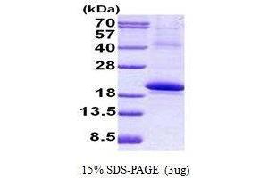 Figure annotation denotes ug of protein loaded and % gel used. (IL18BP Protein)