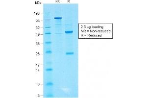SDS-PAGE Analysis of Purified CD99 Rabbit Recombinant Monoclonal Antibody (MIC2/1495R). (Recombinant CD99 antibody)