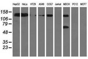 Image no. 2 for anti-L1 Cell Adhesion Molecule (L1CAM) antibody (ABIN1499086) (L1CAM antibody)