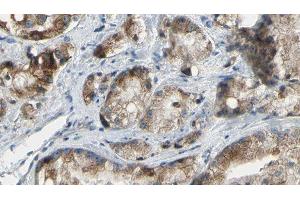 ABIN6277337 at 1/100 staining Human prostate tissue by IHC-P.