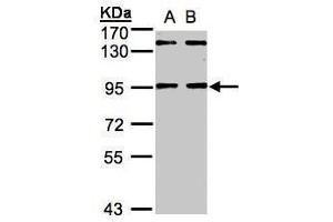 WB Image Sample(30 ug whole cell lysate) A:HeLa S3, B:Hep G2 , 7.