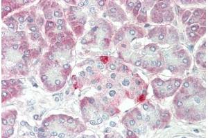 Human, Pancreas: Formalin-Fixed Paraffin-Embedded (FFPE) (SLC1A4 antibody  (C-Term))