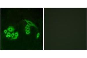 Immunofluorescence analysis of A549 cells, using GPR12 Antibody.
