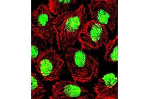 Fluorescent confocal image of U251 cell stained wit. (Nucleolin antibody  (AA 276-304))