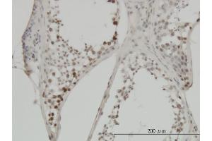 Immunoperoxidase of monoclonal antibody to MYC on formalin-fixed paraffin-embedded human testis.