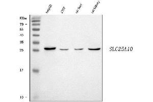 Western blot analysis of Mitochondrial Dicarboxylate Carrier/SLC25A10 using anti-Mitochondrial Dicarboxylate Carrier/SLC25A10 antibody (ABIN7601497).