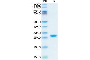 Adipsin Protein (AA 21-253) (His tag)