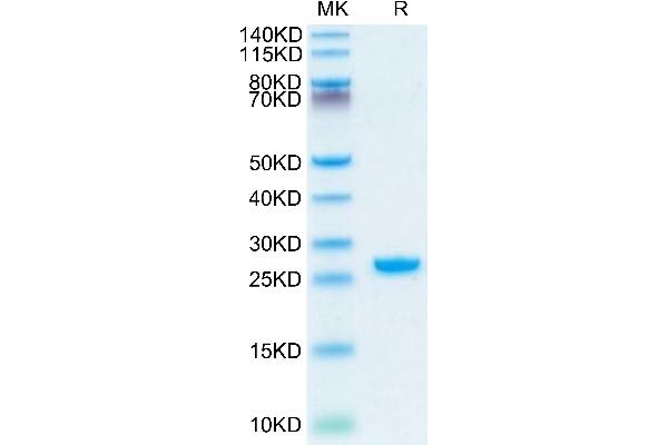 Adipsin Protein (AA 21-253) (His tag)