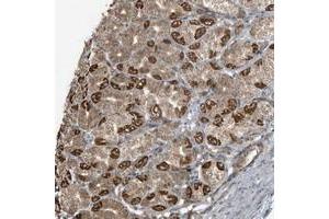 Immunohistochemical staining of human stomach with AZI2 polyclonal antibody  shows strong cytoplasmic positivity in Parietal cells at 1:200-1:500 dilution. (AZI2 antibody)