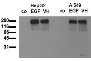Western Blotting (WB) image for anti-Epidermal Growth Factor Receptor (EGFR) (pTyr869) antibody (ABIN126761) (EGFR antibody  (pTyr869))