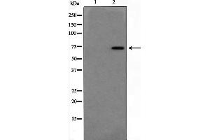 Western blot analysis on Jurkat cell lysate using DUSP16 Antibody,The lane on the left is treated with the antigen-specific peptide. (DUSP16 antibody  (Internal Region))