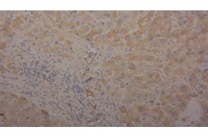 Detection of TF in Human Liver Tissue using Polyclonal Antibody to Transferrin (TF) (Transferrin antibody  (AA 361-683))