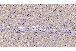 Detection of CD73 in Human Liver Tissue using Monoclonal Antibody to Cluster Of Differentiation 73 (CD73) (CD73 antibody  (AA 29-500))