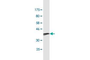 Western Blot detection against Immunogen (38. (S100A9 antibody  (AA 1-114))