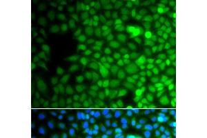 Immunofluorescence analysis of A549 cells using ZNF195 Polyclonal Antibody (ZNF195 antibody)