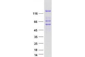 Validation with Western Blot (Lipin 2 Protein (LPIN2) (Myc-DYKDDDDK Tag))