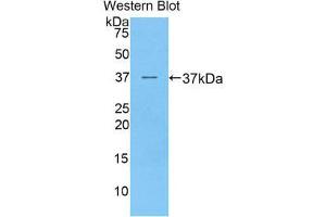 Western Blotting (WB) image for anti-Preferentially Expressed Antigen in Melanoma (PRAME) (AA 416-502) antibody (ABIN3203008) (PRAME antibody  (AA 416-502))