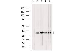 Western blot analysis of extracts from various samples, using TPI1 antibody. (TPI1 antibody  (C-Term))