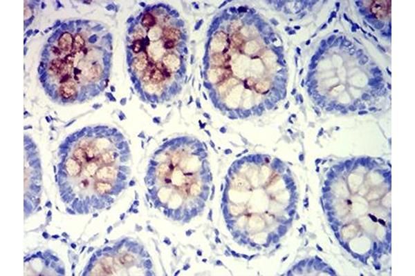MUC5B antibody  (AA 26-166)
