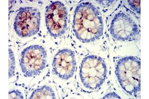 Immunohistochemical analysis of paraffin-embedded rectum tissues using MUC5B mouse mAb with DAB staining. (MUC5B antibody  (AA 26-166))