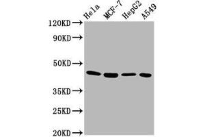 Western Blot Positive WB detected in: Hela whole cell lysate, MCF-7 whole cell lysate, HepG2 whole cell lysate, A549 whole cell lysate All lanes: GNA12 antibody at 5. (GNA12 antibody  (AA 112-270))