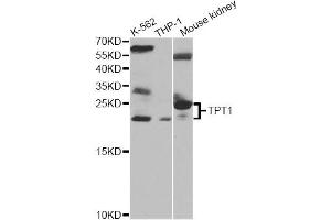 Western blot analysis of extracts of various cell lines, using TPT1 antibody. (TPT1 antibody)