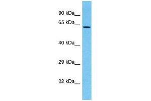 Host:  Rabbit  Target Name:  LRRC15  Sample Type:  721_B Whole Cell lysates  Antibody Dilution:  1. (LRRC15 antibody  (N-Term))