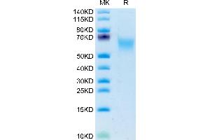 Human CADM1 on Tris-Bis PAGE under reduced condition. (CADM1 Protein (AA 45-374) (His tag))