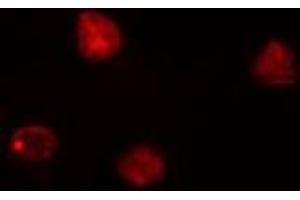 ABIN6276822 staining HeLa cells by IF/ICC. (CDK7 antibody  (Internal Region))