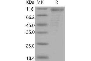 Western Blotting (WB) image for CD36 (CD36) (Active) protein (His tag,Fc Tag) (ABIN7320283) (CD36 Protein (CD36) (His tag,Fc Tag))