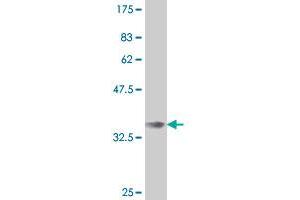 Western Blot detection against Immunogen (35. (IRX3 antibody  (AA 123-209))