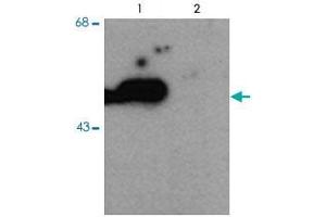 Western blot of HEK293 cells transfected with PARK2 WT (Phospho) and PARK2 S101 mutant (non-phospho) showing the phospho-specific immunolabeling of the ~ 52 k parkin protein.