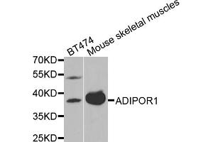 Western blot analysis of extracts of various cell lines, using ADIPOR1 antibody (ABIN5970705) at 1/1000 dilution.