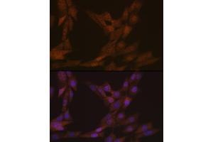 Immunofluorescence analysis of NIH-3T3 cells using KIFC1 Rabbit mAb (ABIN1680485, ABIN3015039, ABIN3015040 and ABIN7101305) at dilution of 1:100 (40x lens). (KIFC1 antibody)