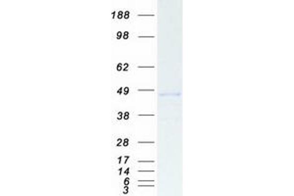 CTBP1 Protein (Transcript Variant 1) (Myc-DYKDDDDK Tag)