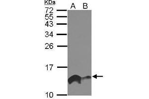 WB Image Sample (30 ug of whole cell lysate) A: A549 B: HeLa 15% SDS PAGE antibody diluted at 1:1000 (IFITM1 antibody)
