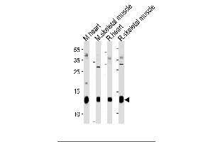 PLM Antibody (E1) (ABIN1882173 and ABIN2844827) western blot analysis in mouse heart,skeletal muscle and rat heart,skeletal muscle tissue lysates (35 μg/lane). (FXYD1 antibody  (N-Term))