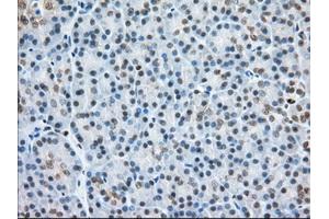 Immunohistochemical staining of paraffin-embedded Human colon tissue using anti-H6PD mouse monoclonal antibody.