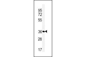 Western blot analysis of MFRN2 Antibody (N-term) (ABIN651437 and ABIN2840240) in Jurkat cell line lysates (35 μg/lane). (SLC25A28 antibody  (N-Term))