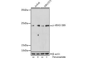 Western blot analysis of extracts of various cell lines, using Phospho-KRAS-S89 Rabbit pAb (ABIN7267530) at 1:500 dilution. (K-RAS antibody  (pSer89))