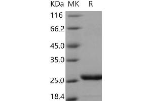 Western Blotting (WB) image for Prolactin (PRL) protein (His tag) (ABIN7320301) (Prolactin Protein (PRL) (His tag))