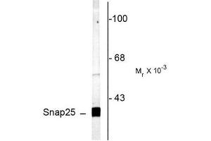 Image no. 1 for anti-Synaptosomal-Associated Protein, 25kDa (SNAP25) (C-Term) antibody (ABIN372714) (SNAP25 antibody  (C-Term))