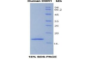 SDS-PAGE (SDS) image for Debranching Enzyme Homolog 1 (DBR1) (AA 243-372) protein (His tag) (ABIN1079351)