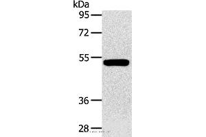 Western blot analysis of Human fetal muscle tissue, using GJA9 Polyclonal Antibody at dilution of 1:400 (GJA9 antibody)
