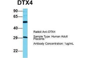 Host: Rabbit  Target Name: DTX4  Sample Tissue: Human Adult Placenta  Antibody Dilution: 1. (Deltex Homolog 4 antibody  (C-Term))