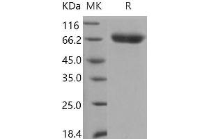 Western Blotting (WB) image for serpin Peptidase Inhibitor, Clade D (Heparin Cofactor), Member 1 (SERPIND1) (Active) protein (His tag) (ABIN7197974) (SERPIND1 Protein (His tag))